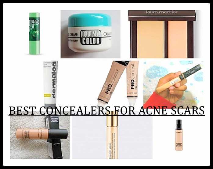 10 Best Concealers for Acne Scars Blemishes: Prices