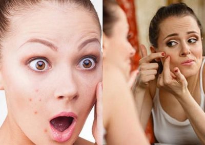 8 Best Herbal Beauty Tips and DIYs for Glowing Skin – Vanitynoapologies