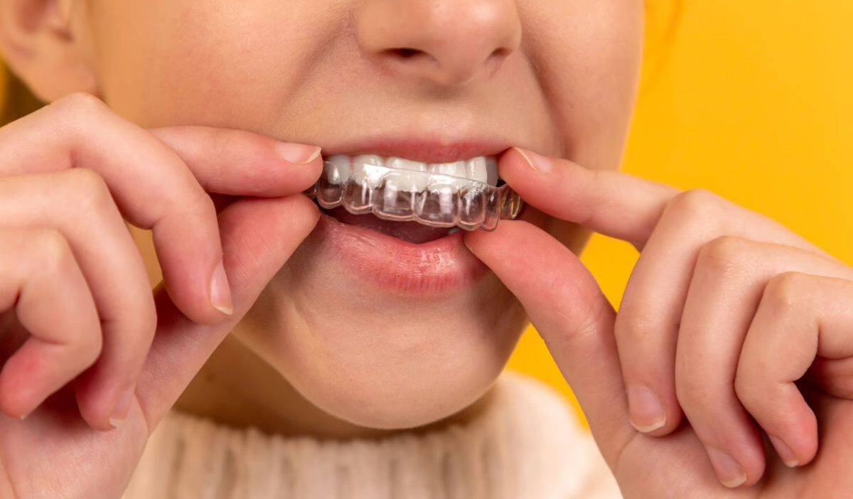 Does Medicaid Cover Invisalign? 7 Thing You Need to Know