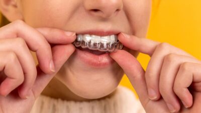 Does Medicaid Cover Invisalign? 7 Thing You Need to Know