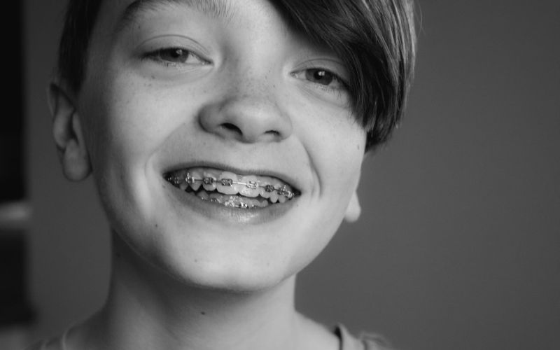 Check in your state plan for does Medicaid cover braces (Image by Unsplash)