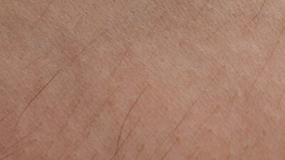 how to get rid of textured skin